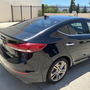 2017 Hyundai ELANTRA LIMITED — фото 9