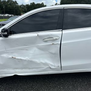 2016 Acura TLX BASE 照片 4