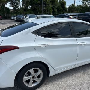 2015 Hyundai ELANTRA SE — фото 9