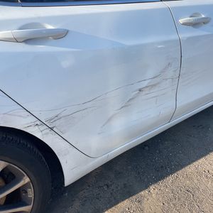 صورة مصغرة 65 لـ 2019 Acura TLX V6